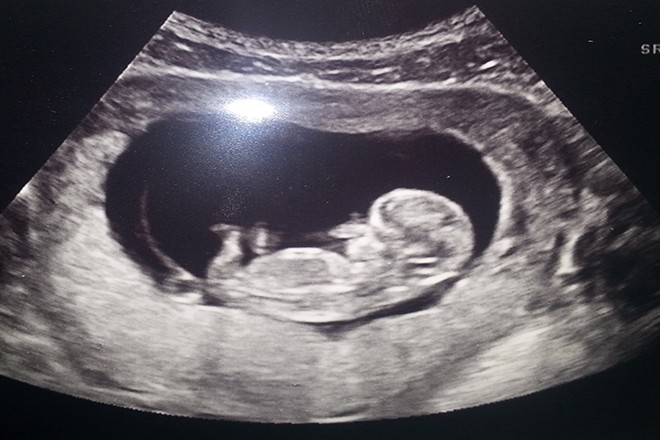 Bunda, si Kecil, hamil 11 minggu,  3 bulan pertama kehamilan, Hamil